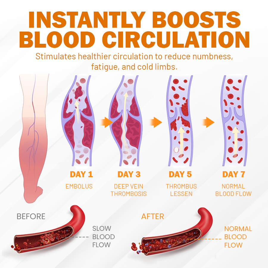 NEGUSY™ Boost Circulation and Relieve Swelling