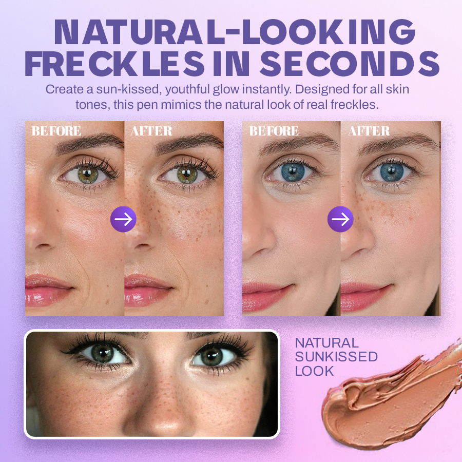NEGUSY™ Quick & Easy Freckles