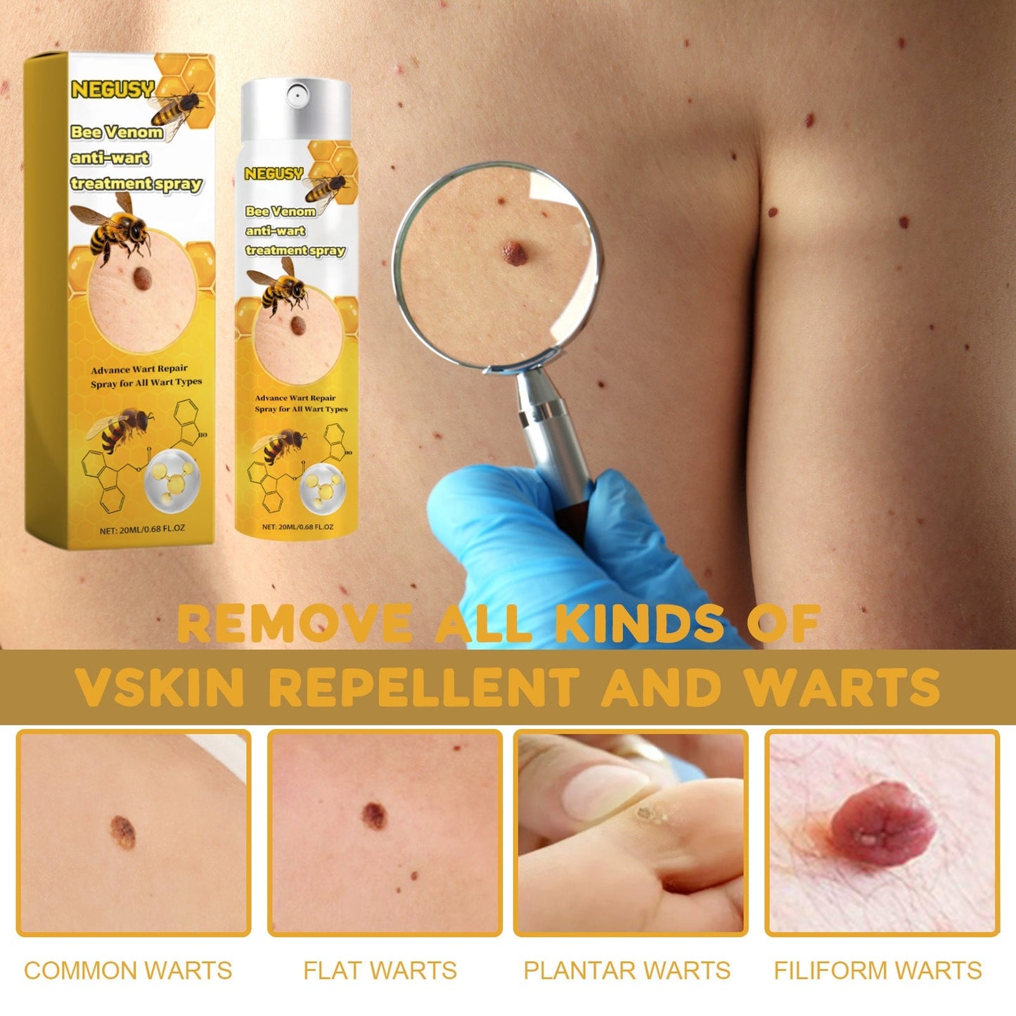 NEGUSY™ Bee Venom anti-wart treatment spray