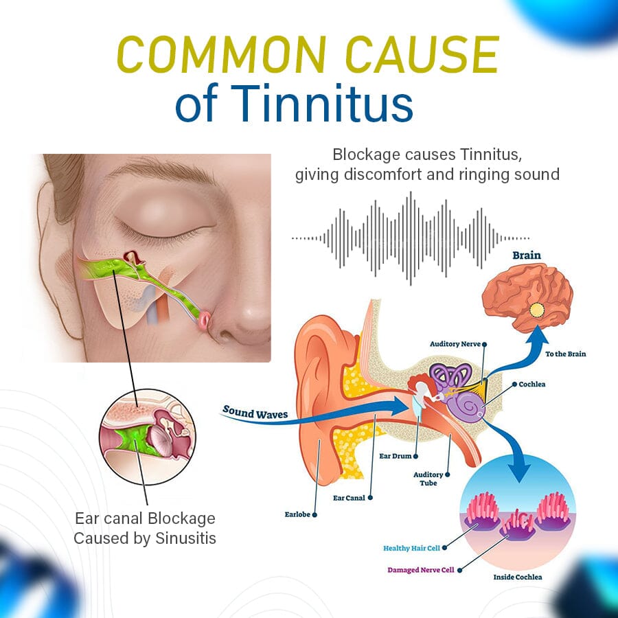 Tinnseal™ Goldenseal Nasal Spray for Tinnitus
