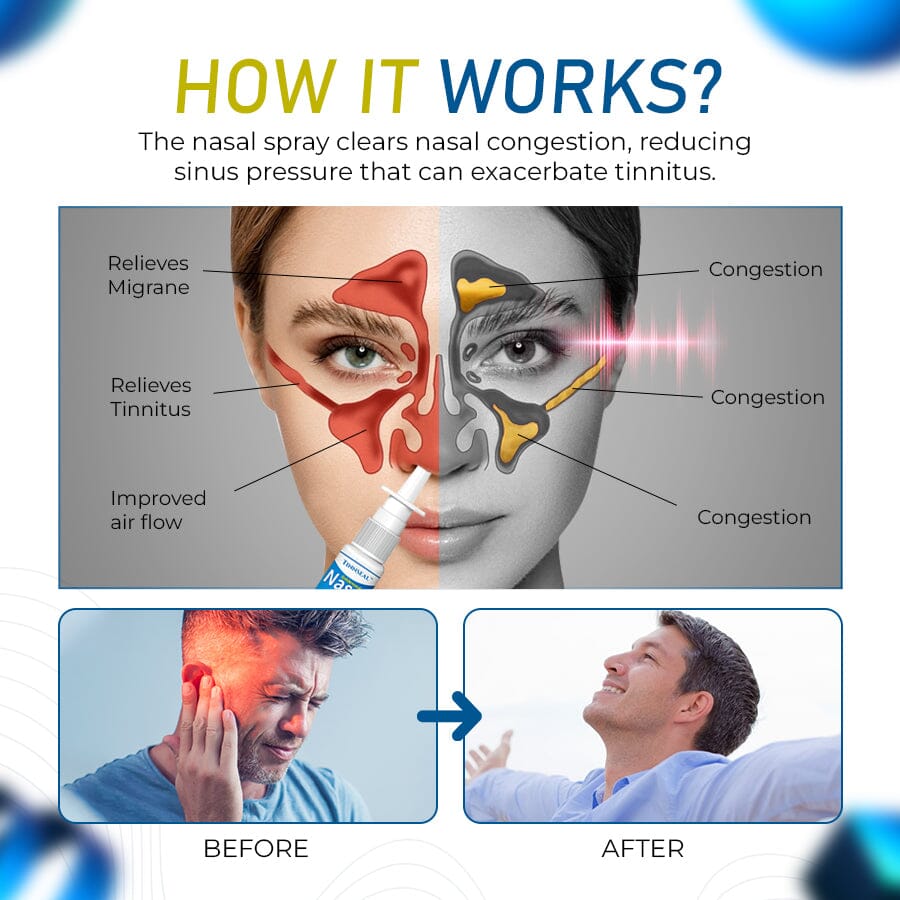 Tinnseal™ Goldenseal Nasal Spray for Tinnitus