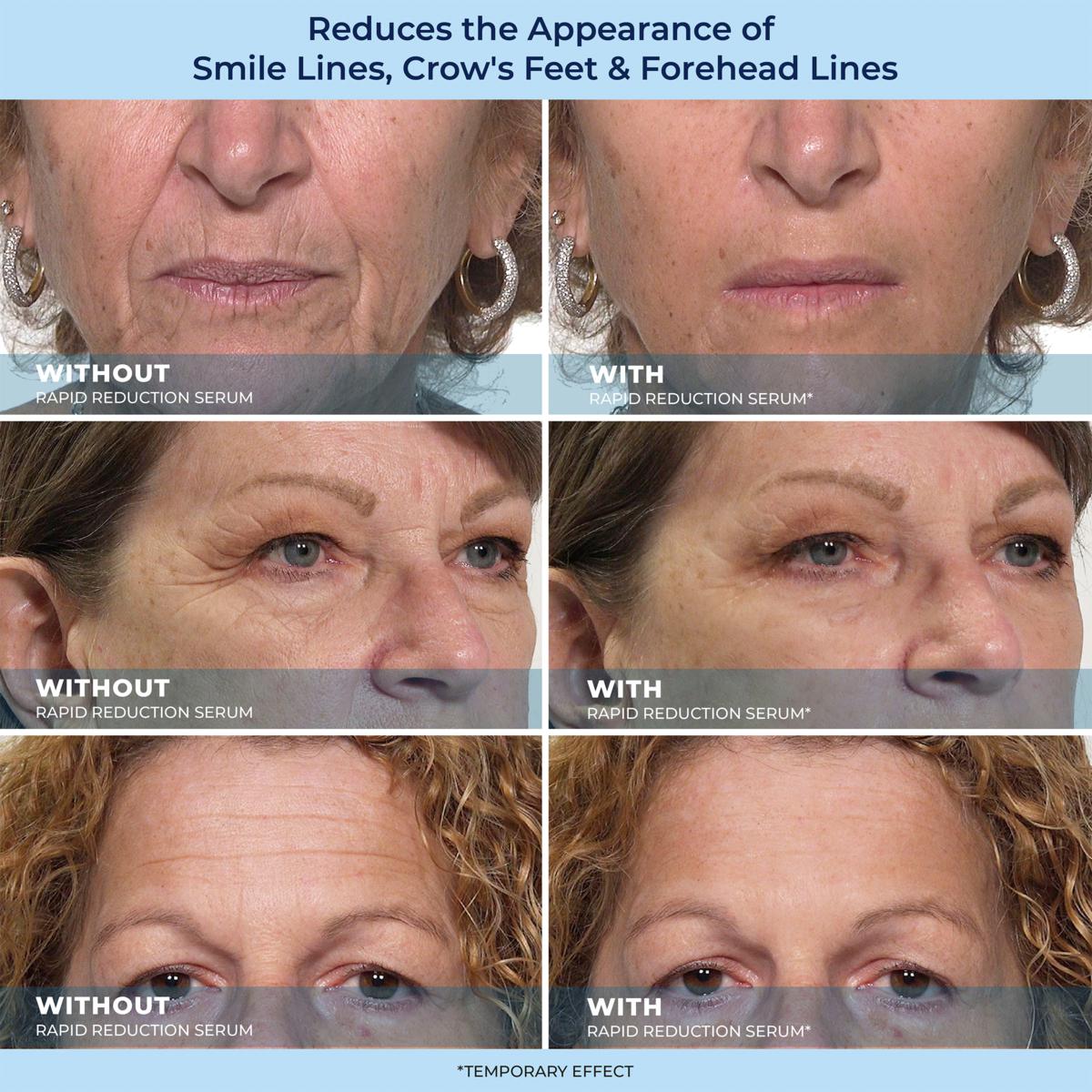 LBMLBM™ Rapid Reduction Wrinkle Serum1