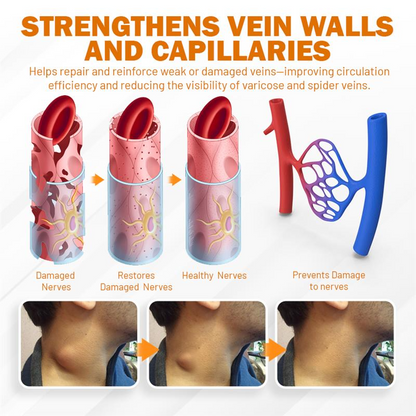 NEGUSY™ Boost Circulation and Relieve Swelling