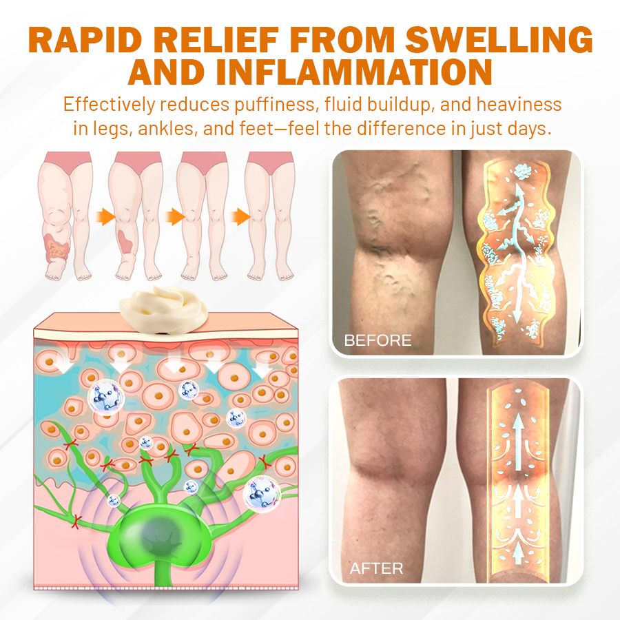 NEGUSY™ Boost Circulation and Relieve Swelling