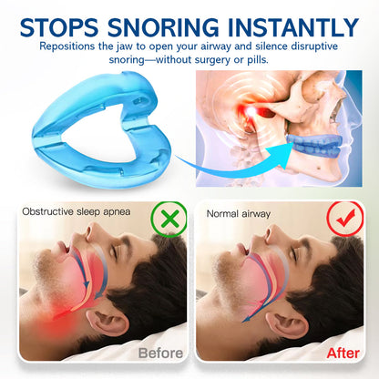 NEGUSY™ Silent Sleep Mouthpiece