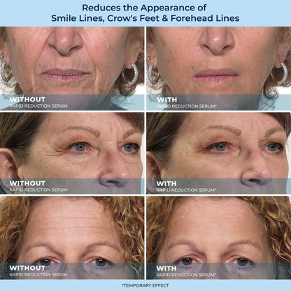 LBMLBM™ Rapid Reduction Wrinkle Serum1